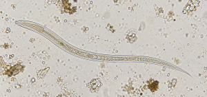 Fotomicrografia ilustrativa de larva rabditoide de Strongyloides em preparação fecal.