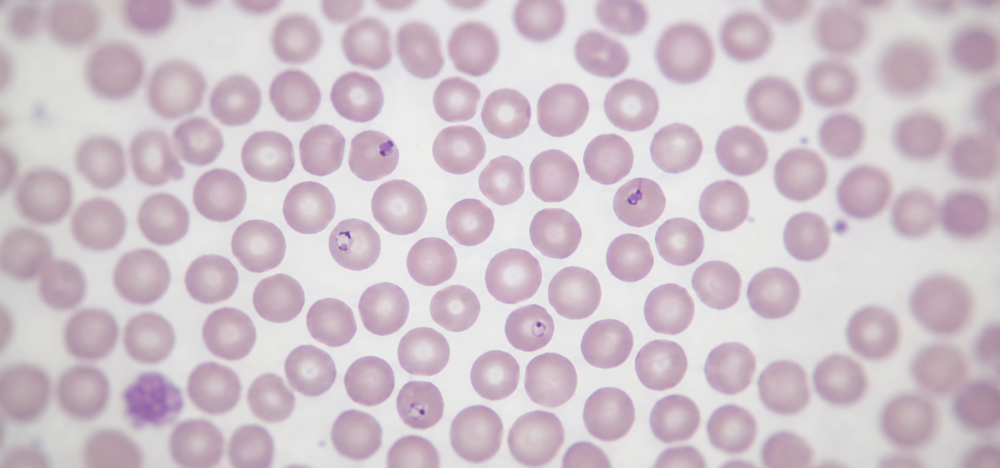 18_Protozoarios_Hemoparasitas_Producao_Guia_Rapido CAPA Protozoários Hemoparasitas de Animais de Produção – Guia Rápido