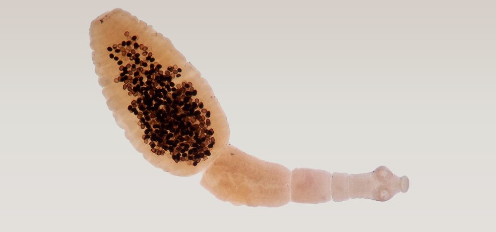 Echinococcus-granulosus—Dossiê-do-Parasita Echinococcus granulosus - Dossiê do Parasita