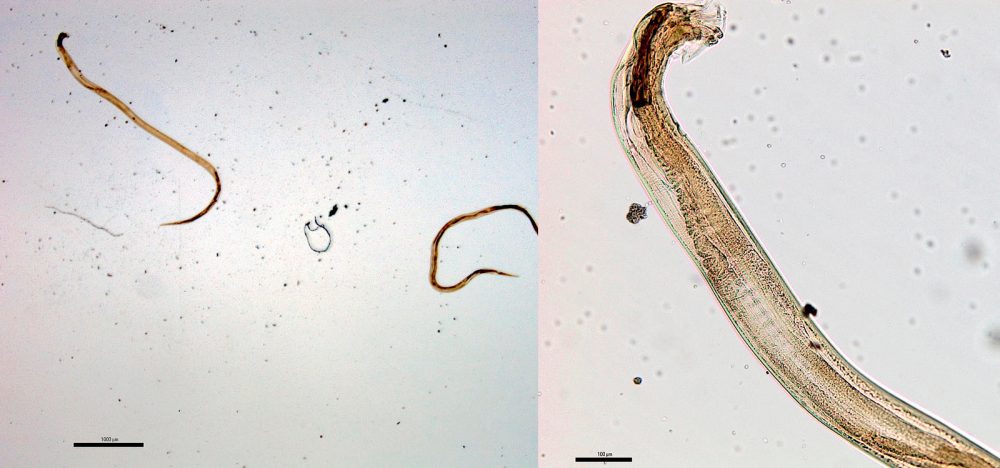 Ostertagia-ostertagi—Dossiê-do-Parasita Ostertagia ostertagi - Dossiê do Parasita