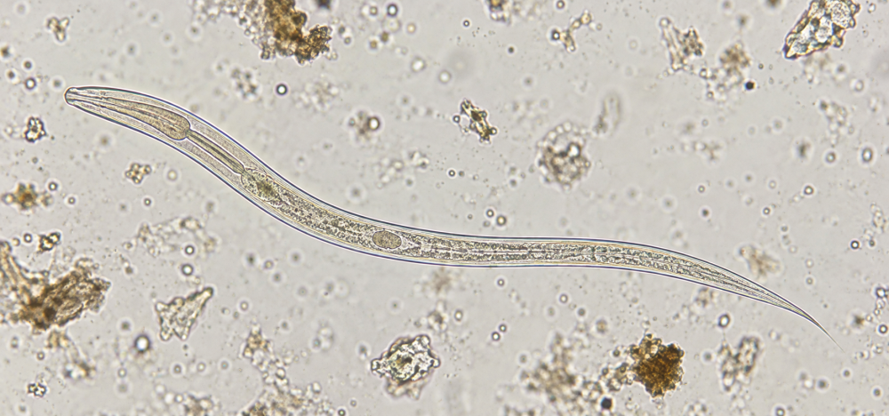 Strongyloides spp. — larva rabditoide em microscopia Fotomicrografia ilustrativa de larva rabditoide de Strongyloides em preparação fecal.