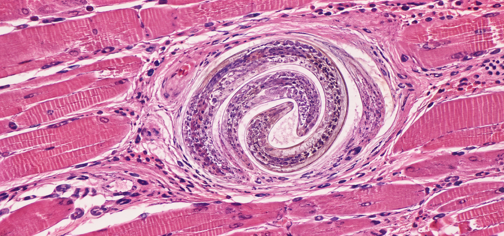 Trichinella spiralis em musculatura estriada – capa do dossiê Larva encistada de Trichinella spiralis em fibra muscular estriada, em fotomicrografia histológica.